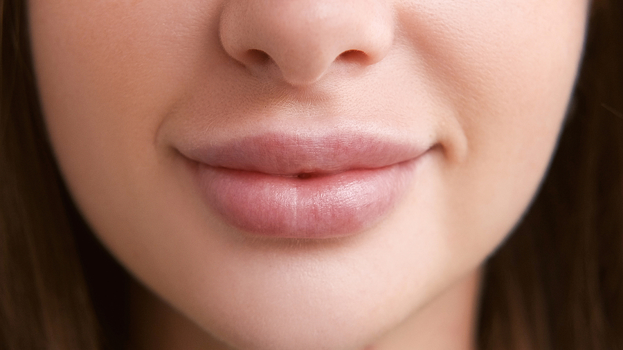 Get Fuller Lips With Lip Fillers